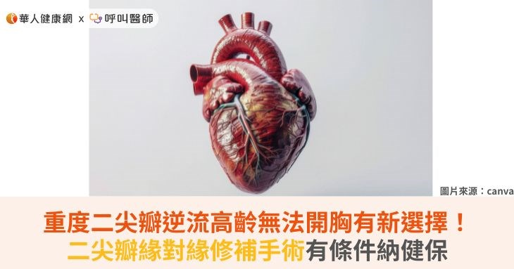 重度二尖瓣逆流高齡無法開胸有新選擇!二尖瓣緣對緣修補手術有條件納健保