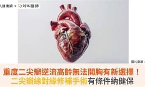 重度二尖瓣逆流高齡無法開胸有新選擇!二尖瓣緣對緣修補手術有條件納健保