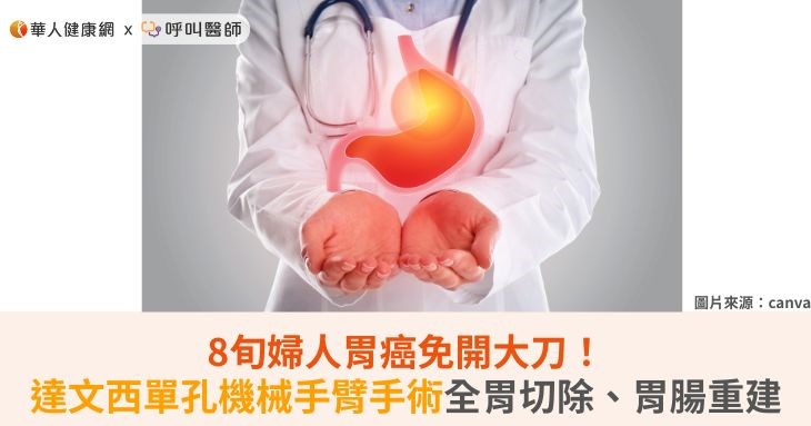 8旬婦人胃癌免開大刀!達文西單孔機械手臂手術全胃切除、胃腸重建