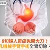 8旬婦人胃癌免開大刀！達文西單孔機械手臂手術全胃切除、胃腸重建