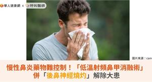 慢性鼻炎藥物難控制！「低溫射頻鼻甲消融術」併「後鼻神經燒灼」解除大患