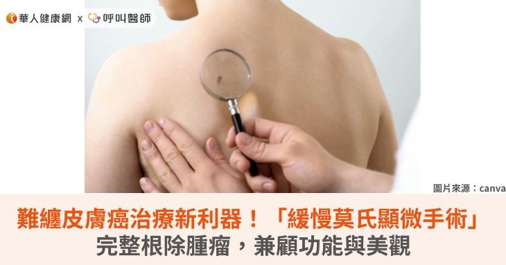 難纏皮膚癌治療新利器!「緩慢莫氏顯微手術」完整根除腫瘤,兼顧功能與美觀