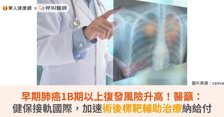 早期肺癌1B期以上復發風險升高!醫籲:健保接軌國際,加速術後標靶輔助治療納給付