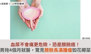 血尿不會痛更危險，恐是膀胱癌！男拖4個月就醫，驚見膀胱長滿腫瘤如花椰菜