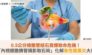 0.5公分總膽管結石竟爆致命危機!「內視鏡膽胰管攝影取石術」化解急性膽囊炎大患