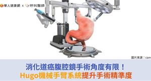 消化道癌腹腔鏡手術角度有限！Hugo機械手臂系統提升手術精準度
