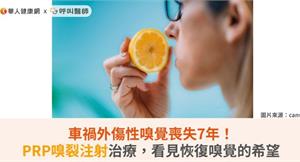車禍外傷性嗅覺喪失7年！PRP嗅裂注射治療，看見恢復嗅覺的希望
