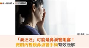 「淚汪汪」可能是鼻淚管阻塞！微創內視鏡鼻淚管手術有效緩解