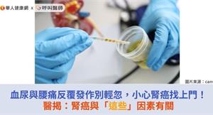 血尿與腰痛反覆發作別輕忽，小心腎癌找上門！醫揭：腎癌與「這些」因素有關