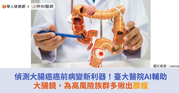 偵測大腸癌癌前病變新利器!臺大醫院AI輔助大腸鏡,為高風險族群多揪出腺瘤