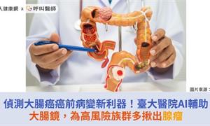 偵測大腸癌癌前病變新利器！臺大醫院AI輔助大腸鏡，為高風險族群多揪出腺瘤