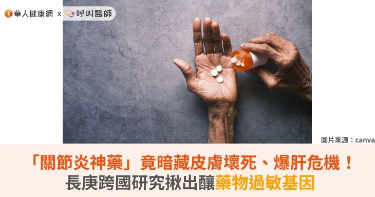 「關節炎神藥」竟暗藏皮膚壞死、爆肝危機!長庚跨國研究揪出釀藥物過敏基因