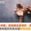 「關節炎神藥」竟暗藏皮膚壞死、爆肝危機！長庚跨國研究揪出釀藥物過敏基因