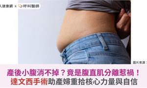 產後小腹消不掉?竟是腹直肌分離惹禍!達文西手術助產婦重拾核心力量與自信