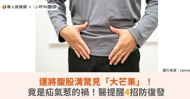 運將腹股溝驚見「大芒果」!竟是疝氣惹的禍!醫提醒4招防復發