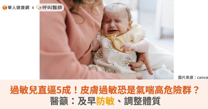 台灣過敏兒直逼5成!皮膚過敏恐是氣喘高危險群?醫籲:及早防敏、調整體質