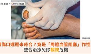 腳傷口遲遲未癒合？竟是「周邊血管阻塞」作怪！整合治療免除截肢危機