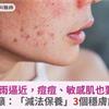 強颱風雨逼近，痘痘、敏感肌也要防災！醫籲：「減法保養」3個穩膚訣竅