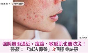 強颱風雨逼近，痘痘、敏感肌也要防災！醫籲：「減法保養」3個穩膚訣竅
