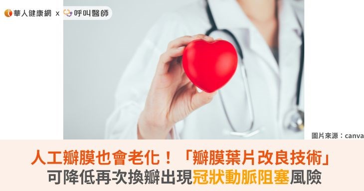 人工瓣膜也會老化!「瓣膜葉片改良技術」可降低再次換瓣出現冠狀動脈阻塞風險