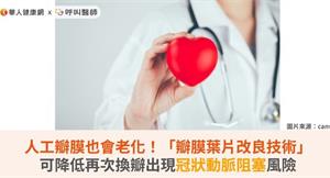 人工瓣膜也會老化！「瓣膜葉片改良技術」可降低再次換瓣出現冠狀動脈阻塞風險