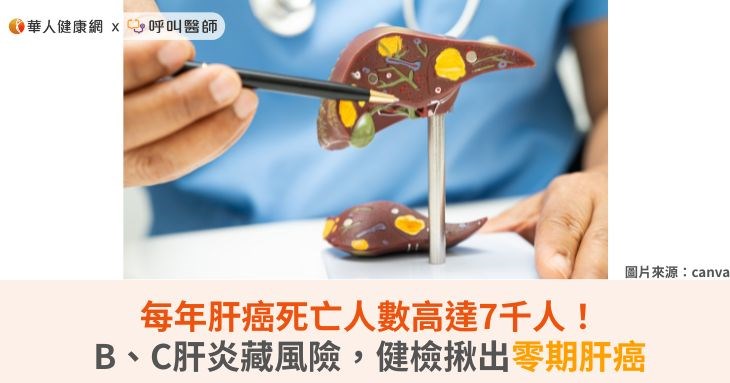 每年肝癌死亡人數高達7千人!B、C肝炎藏風險,健檢揪出零期肝癌