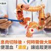 大腸癌前息肉切除後，何時需做大腸鏡追蹤？糞便潛血「濃度」讓追蹤更精準