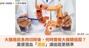 大腸癌前息肉切除後，何時需做大腸鏡追蹤？糞便潛血「濃度」讓追蹤更精準