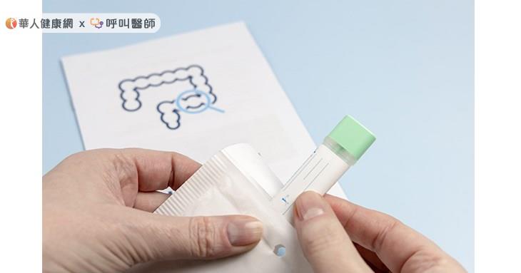糞便潛血「濃度」讓大腸息肉切除後的追蹤更精準。