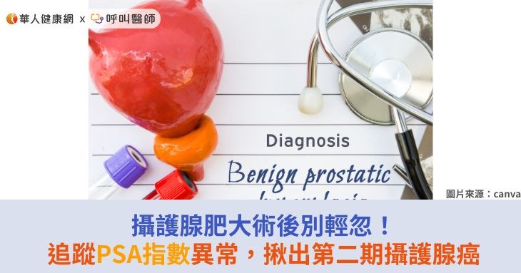 攝護腺肥大術後別輕忽!追蹤PSA指數異常,揪出第二期攝護腺癌