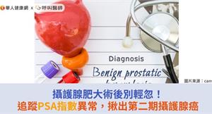 攝護腺肥大術後別輕忽！追蹤PSA指數異常，揪出第二期攝護腺癌