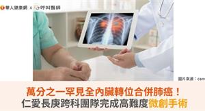 萬分之一罕見全內臟轉位合併肺癌！仁愛長庚跨科團隊完成高難度微創手術