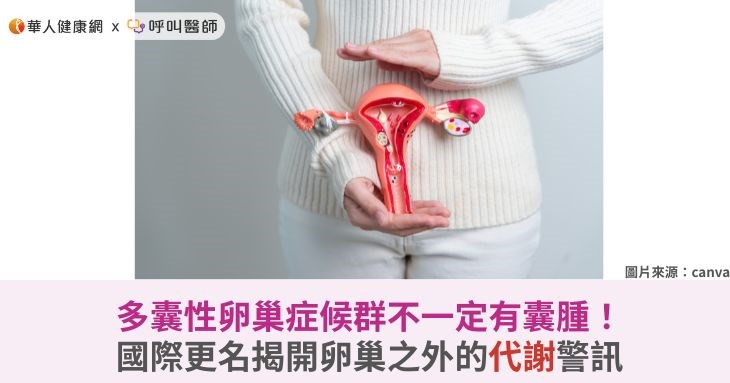 多囊性卵巢症候群不一定有囊腫!國際更名揭開卵巢之外的代謝警訊