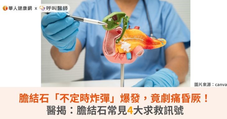 膽結石「不定時炸彈」爆發,竟劇痛昏厥!醫揭:膽結石常見4大求救訊號