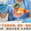 膽結石「不定時炸彈」爆發，竟劇痛昏厥！醫揭：膽結石常見4大求救訊號