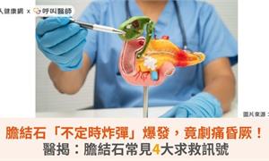 膽結石「不定時炸彈」爆發，竟劇痛昏厥！醫揭：膽結石常見4大求救訊號