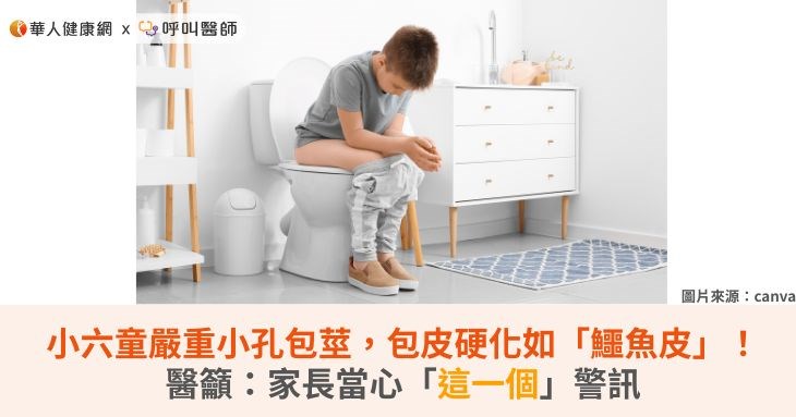 小六童嚴重小孔包莖,包皮硬化如「鱷魚皮」!醫籲:家長當心「這一個」警訊