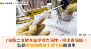 7旬翁二度檢查糞便潛血陽性，揪出直腸癌！彰基達文西機器手臂手術助重生