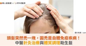 頭髮突然禿一塊，圓禿是自體免疫疾病！中醫針灸治療與體質調理助生髮