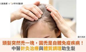 頭髮突然禿一塊，圓禿是自體免疫疾病！中醫針灸治療與體質調理助生髮