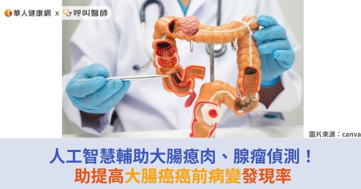 人工智慧輔助大腸瘜肉、腺瘤偵測!助提高大腸癌癌前病變發現率