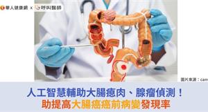 人工智慧輔助大腸瘜肉、腺瘤偵測！助提高大腸癌癌前病變發現率