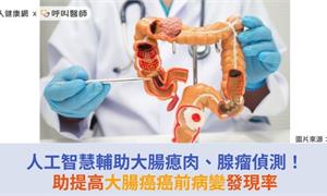 人工智慧輔助大腸瘜肉、腺瘤偵測！助提高大腸癌癌前病變發現率
