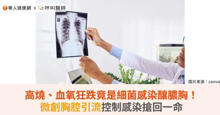 高燒、血氧狂跌竟是細菌感染釀膿胸!微創胸腔引流控制感染搶回一命