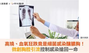 高燒、血氧狂跌竟是細菌感染釀膿胸！微創胸腔引流控制感染搶回一命