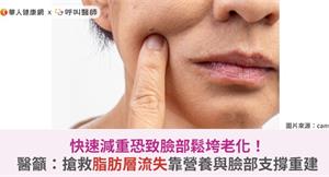 快速減重恐致臉部鬆垮老化！醫籲：搶救脂肪層流失靠營養與臉部支撐重建