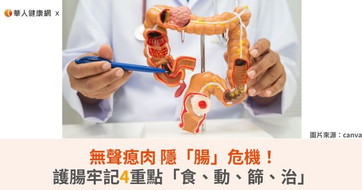 無聲瘜肉隱「腸」危機!護腸牢記4重點「食、動、篩、治」