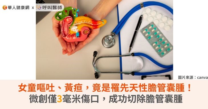 女童嘔吐、黃疸,竟是罹先天性膽管囊腫!微創僅3毫米傷口,成功切除膽管囊腫