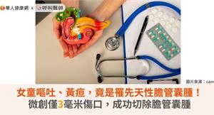 女童嘔吐、黃疸，竟是罹先天性膽管囊腫！微創僅3毫米傷口，成功切除膽管囊腫