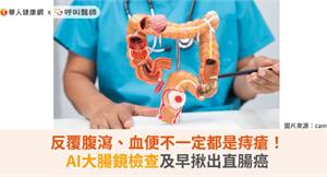 反覆腹瀉、血便不一定都是痔瘡！AI大腸鏡檢查及早揪出直腸癌